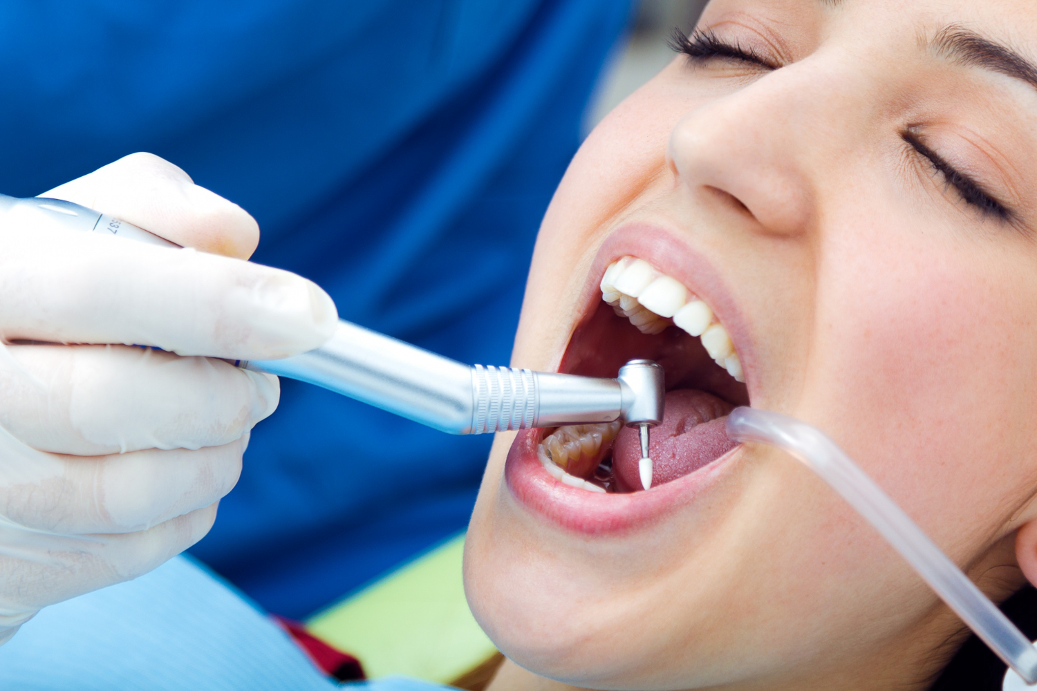 Root Canal