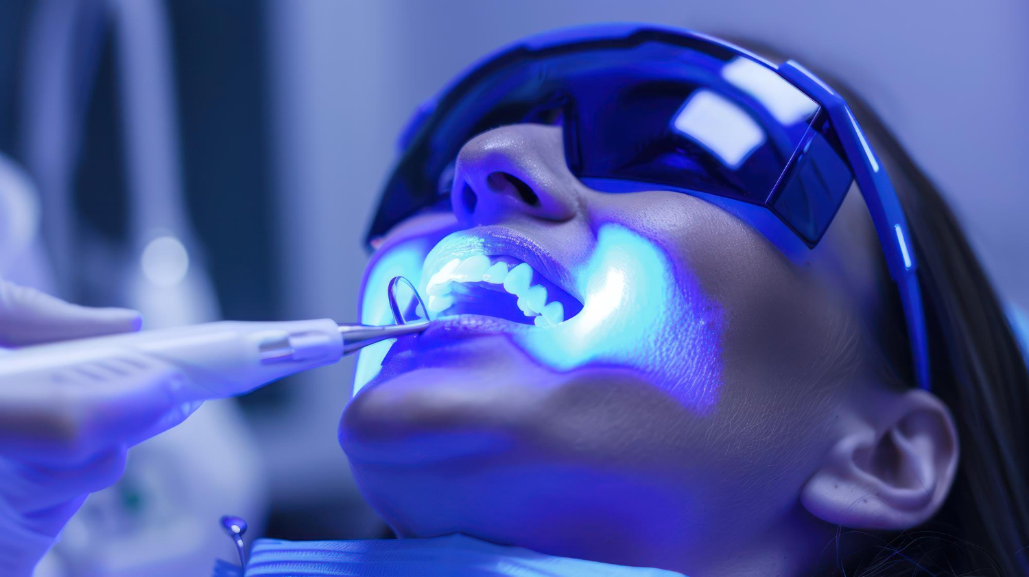 Teeth Whitening